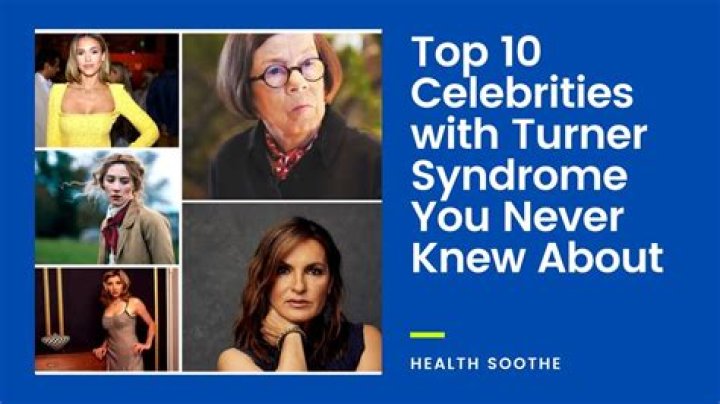 Discovering 10 Famous People And Celebrities With Turner